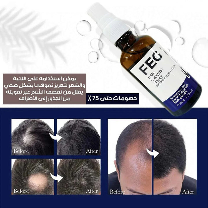 FEG Hair Growth Spray_1_image