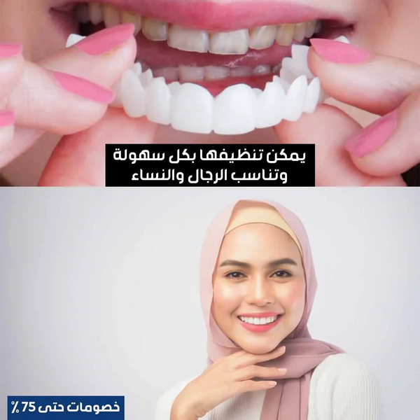 Hollywood Smile Teeth